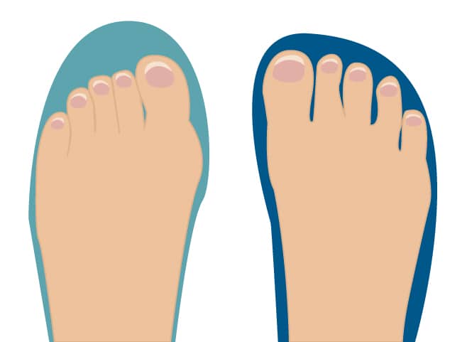 Is Your Toe Box Wide Enough? The Simple Test for Running Success