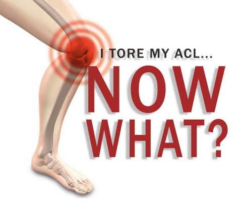 the risk prevention and treatment of acl injuries common among athletes Ankle sprains are the most common injuries among young athletes prevention of sports injuries in young athletes any sport has the risk of injury. the risk prevention and treatment of acl injuries common among athletes Ankle sprains are the most common injuries among young athletes prevention of sports injuries in young athletes any sport has the risk of injury.